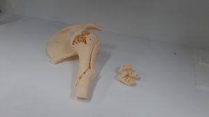 Laboratório de tecnologia 3D do Nutes desenvolve guias para auxílio de cirurgias em diversas áreas